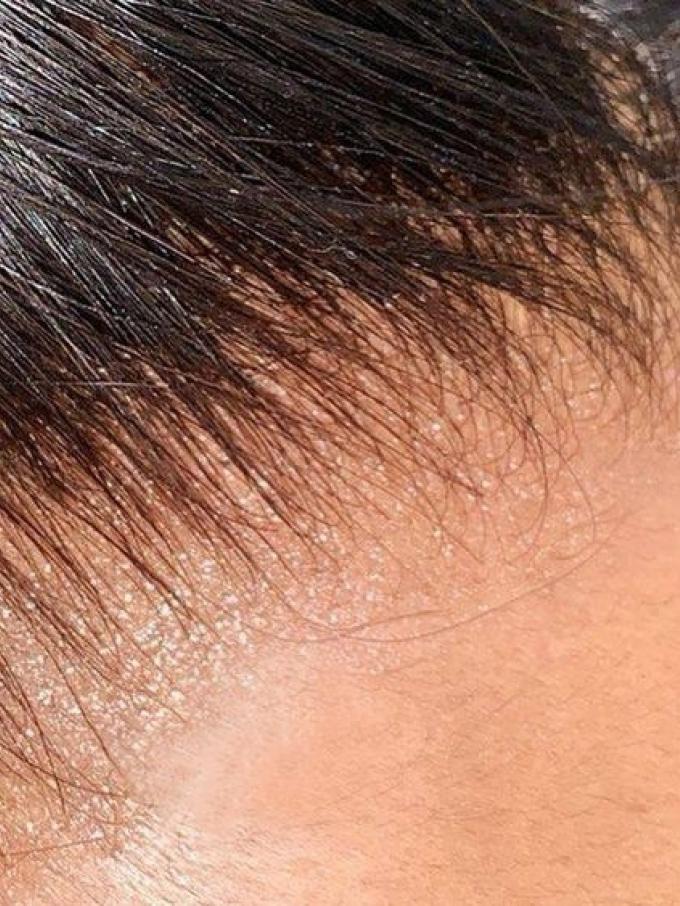 13*6 SUPER FINE INVISIBLE HD LACE-GORGEOUS HUMAN HAIR LACE FRONTAL WIG WITH WAND CURLS- HD922